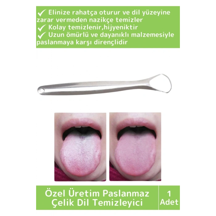 Özel Yüksek Kaliteli Paslanmaz Çelik Kolay Temizlenir Ağız Kokusu Önleyici Hijyenik Dil Temizleyici