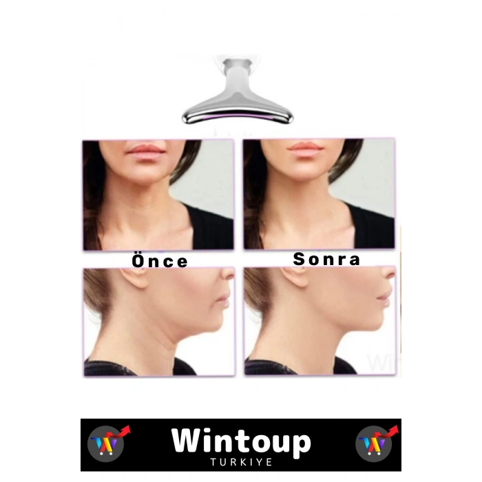 Özel Titreşim Isıtma Özellikli Işık Terapisi Cilt Sıkılaştırıcı Yüz Masaj Cihazı