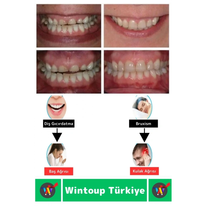 Diş Çene Sıkma Gıcırdatma Bruksizm Önleyici Gece Plağı Koruyucu Uyku Aparatı Protez Kaplı 2 Adet