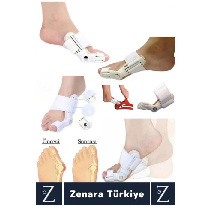 Premium Her İki Ayak İçin Uyumlu Yıkanabilir Kolay Temizlenir Baş Parmak Kemik Düzeltici Atel 2 Adet