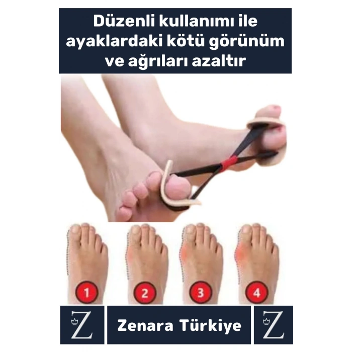 Premium Yumuşak Dokulu Rahat Kötü Görünüm Düzelten Fizyoterapi Ayak Baş Parmak Egzersiz Lastiği