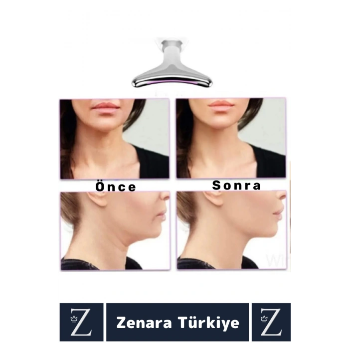 Premium Titreşimli Isıtma Özellikli Işık Terapisi Kırışıklık Cilt Sıkılaştırıcı Yüz Masaj Cihazı