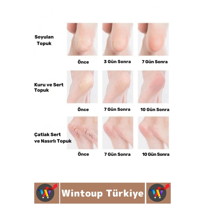 Unisex Ergonomik Konforlu Kaymaz Ağrı Azaltan Esnek Silikon Nemlendirici Topuk Çorabı