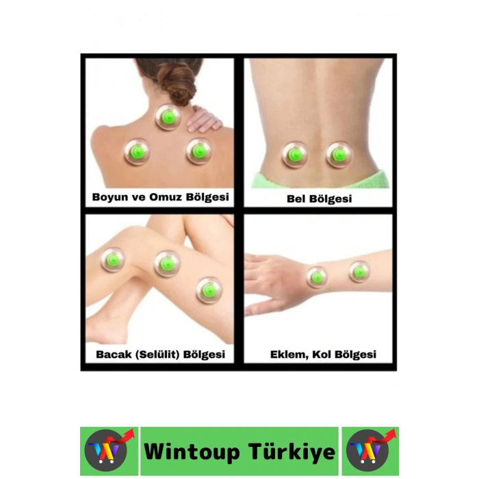 #HacamatSeti 10 Adet 5-6-7 No Kupa Islak Kuru Kullanıma Uygun 4 Parmak Pompa Hediyeli Hacamat Seti