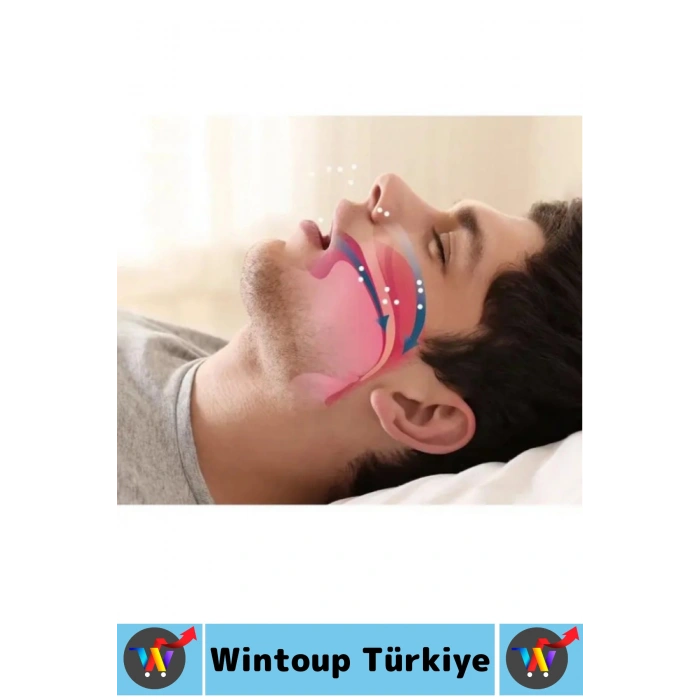 #HorlamaÖnleyici Rahat Nefes Alıp Verme Uyku Seyahat Horlama Azaltıcı Önleyici Burun Aparatı 2 Adet