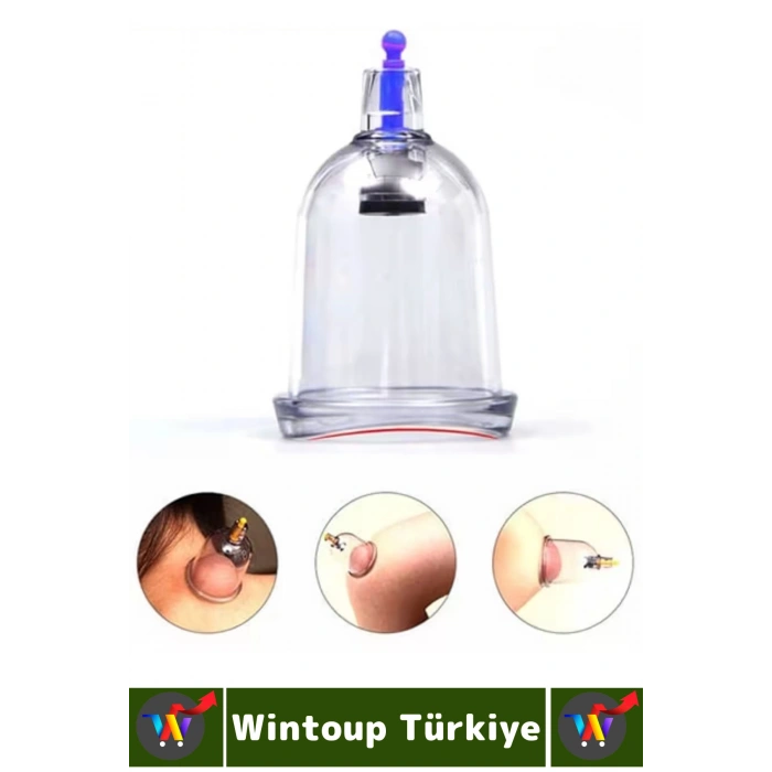 #Hacamat Geleneksel Tedavi 100 Adet 5 No Selülit Çatlak Giderici Vakumlu Kupa Seri 1 Adet Yüz Hassas Bölge Uyumlu Tek İz Otomatik Kalem Premium Hacamat Seti