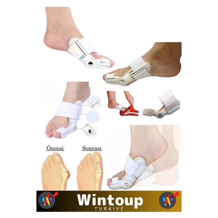 Özel Seri Yıkanabilir Standart Size Sağ Sol Ayak Uyumlu Baş Parmak Kemik Düzeltici 1 Adet