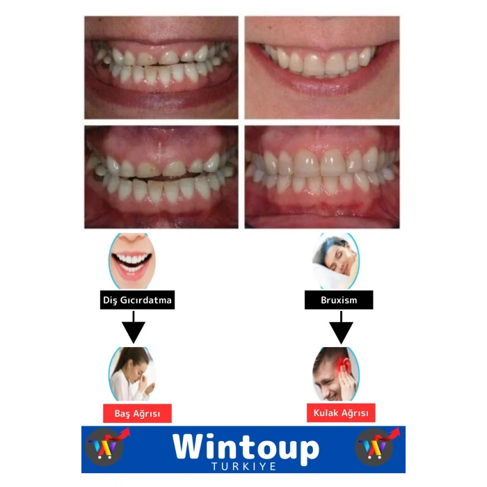 Özel Tasarım Çene Sıkma Diş Gıcırdatma Bruxism Gece Plağı Koruyucu Aparat Dişlik Uyku Aparatı 1 Adet