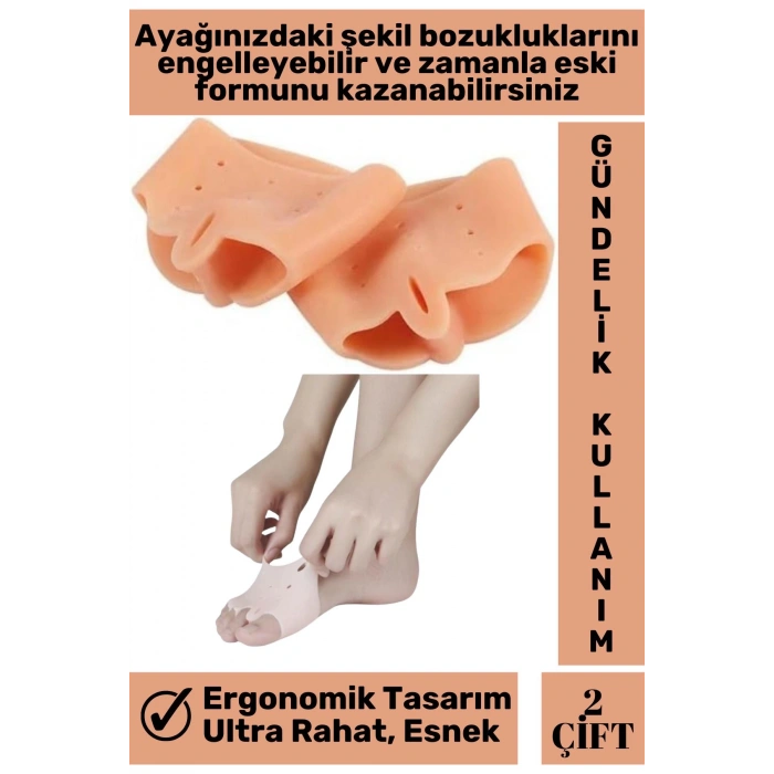 Premium Bunyon Ayak Baş Parmak Kemik Koruyucu Silikon Makaralı Ayak Parmak Ayırıcı Düzeltici 2 Çift