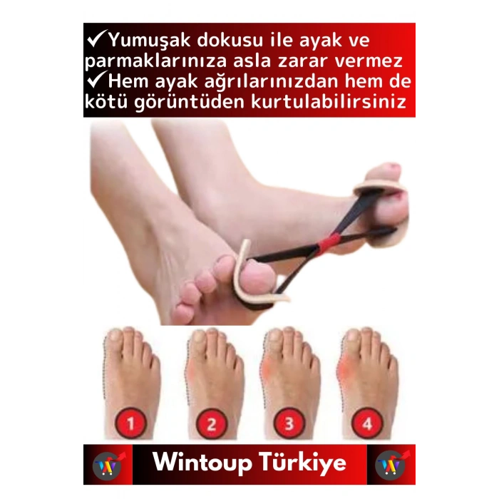 Premium Ortopedik Ekstra Yumuşak Rahat Bunyon Ayak Baş Parmak Egzersiz Fizyoterapi Direnç Lastiği