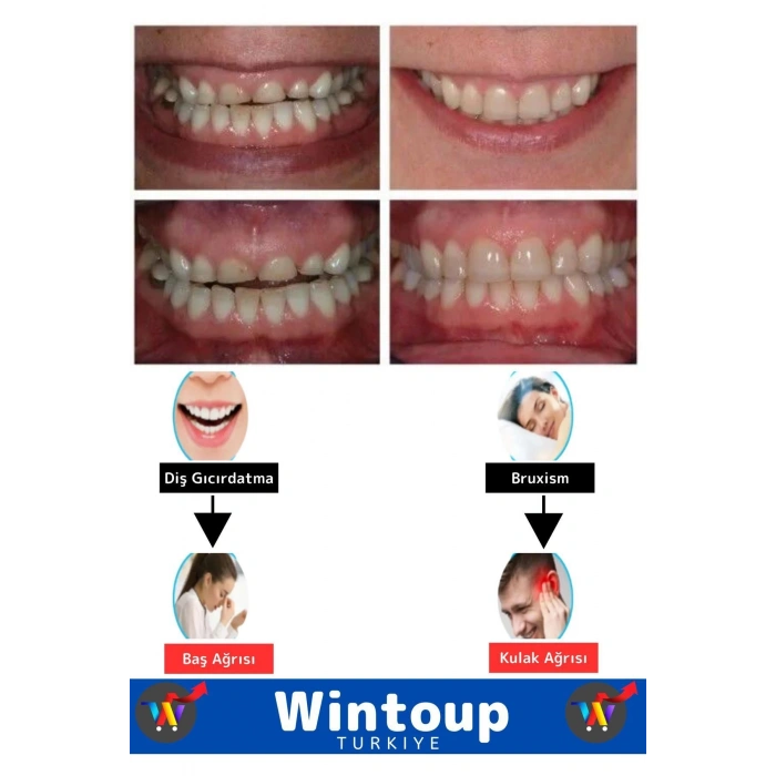 Premium Seri Bruxism Çene Sıkma Diş Gıcırdatma Koruyucu Aparatı Dişlik Gece Plağı Dişlik