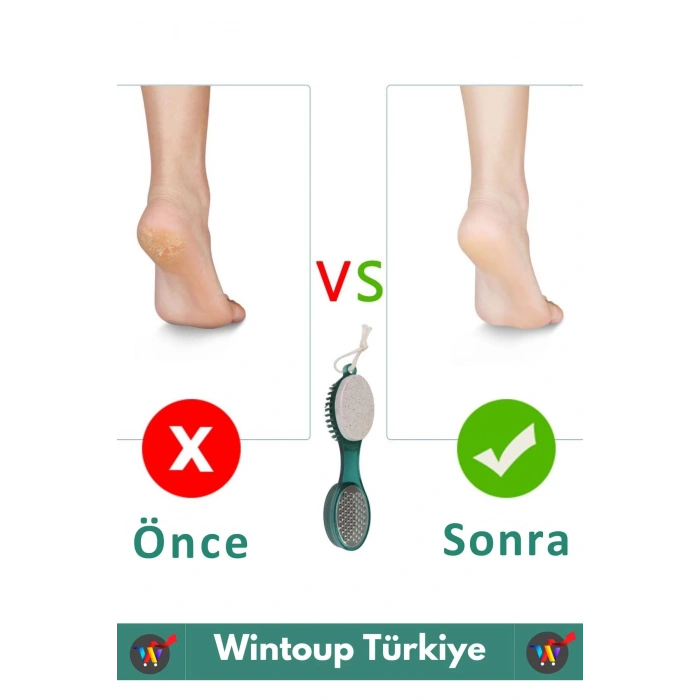 Premium Seri Yüksek Kaliteli Ayak Topuk Bakım 4 in 1 Multifonksiyonel Ayak Topuk Bakım Aleti Törpü
