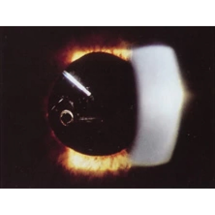 Kapı Accent 2000-2005 Ön Jpi Sol  Az Hasarlı (Oem No:0110060F(L))