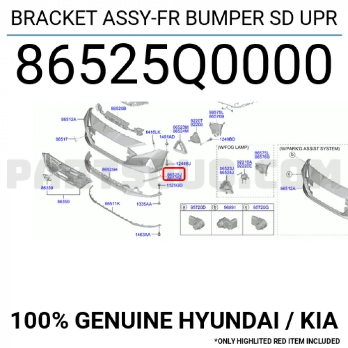 Tampon Bağlantı Braketi I-2020 Ön 2021 Sonrası Üst Sol (Oem No:86525Q0000)