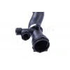 Radyatör Hortumu Üst Bmw E46 M57 99-02 (Oem No: 11532247849)