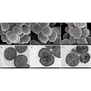 Debrıyaj Setı Psa 206/207/Bıpper/Nemo 1.4 Hdı 2007- (Oem No: 1611266580/1611284980)