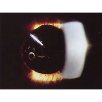 Kapı Accent 2000-2005 Ön Jpi Sol  Az Hasarlı (Oem No:0110060F(L))