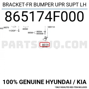 Tampon Bağlantı Braketi Kmy Ön 2005 Sonrası Üst Sol (Oem No:865174F000)