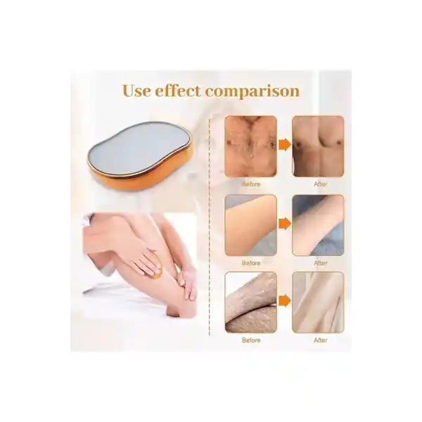 Lacivert Renk Epilasyon Aleti Tüy Dökücü Kristal Taş