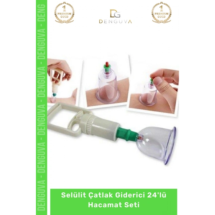 #HacamatSeti Vakumlu Masaj Karşıtı Terapi Cihazı 24lü Kupa Hacamat Seti - 24 - Adet