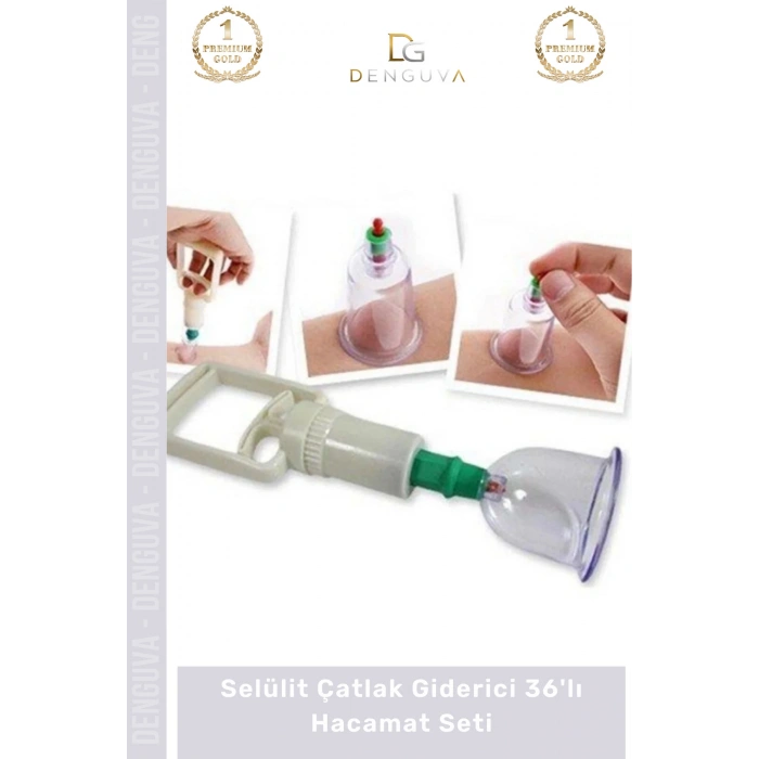 #HacamatSeti Vakumlu Masaj Karşıtı Terapi Cihazı 36lı Kupa Hacamat Seti - 36 - Adet
