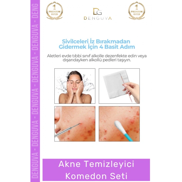 #AkneTemizleyici Siyah Nokta Giderici Bakım Seti Profesyonel Yüz Aparatı Akne Temizleyici Kutulu Komedon