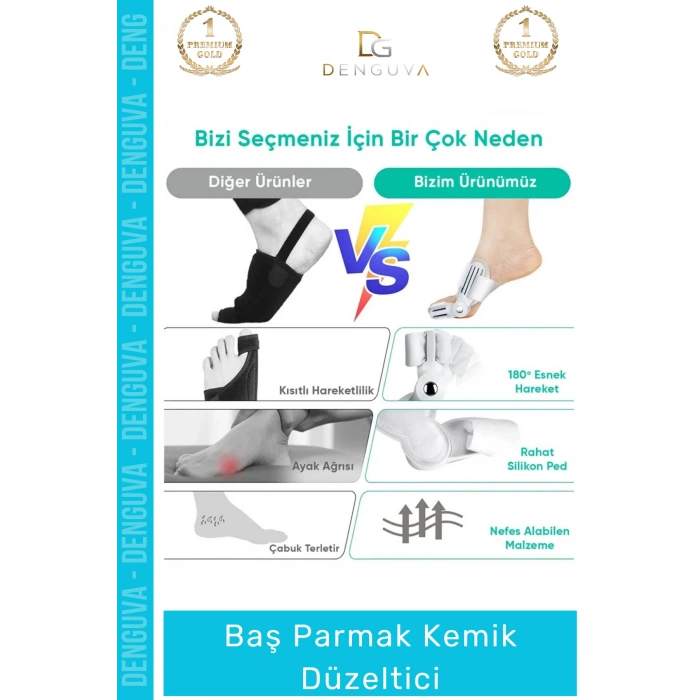 #ParmakDüzeltici Ortopedik Hallux Valgus Gece Gündüz Ateli Ayak Sağlığı Parmak Kemik Düzeltici 1 - Adet