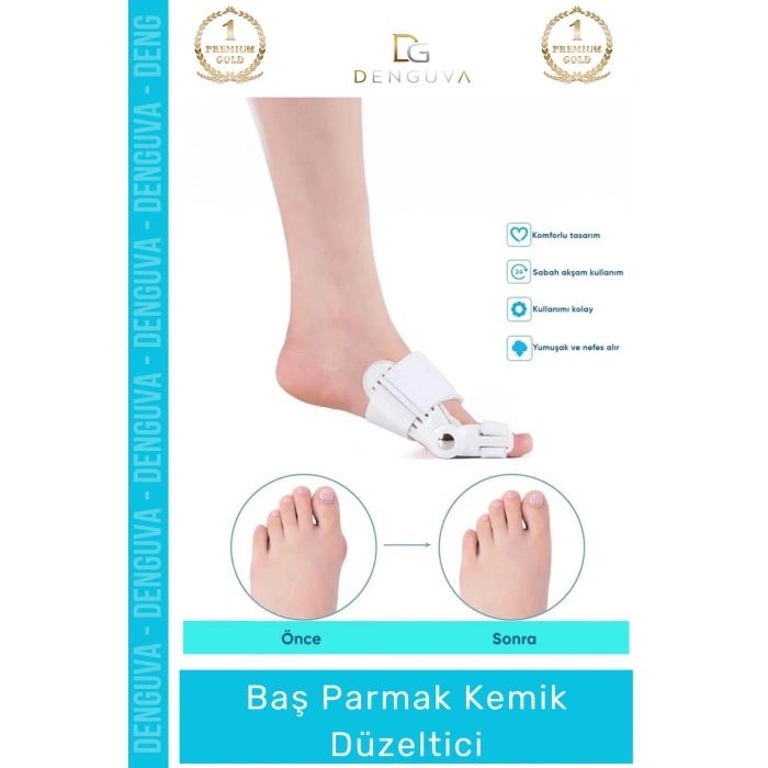 #ParmakDüzeltici Ortopedik Hallux Valgus Gece Gündüz Ateli Ayak Sağlığı Parmak Kemik Düzeltici 1 - Adet