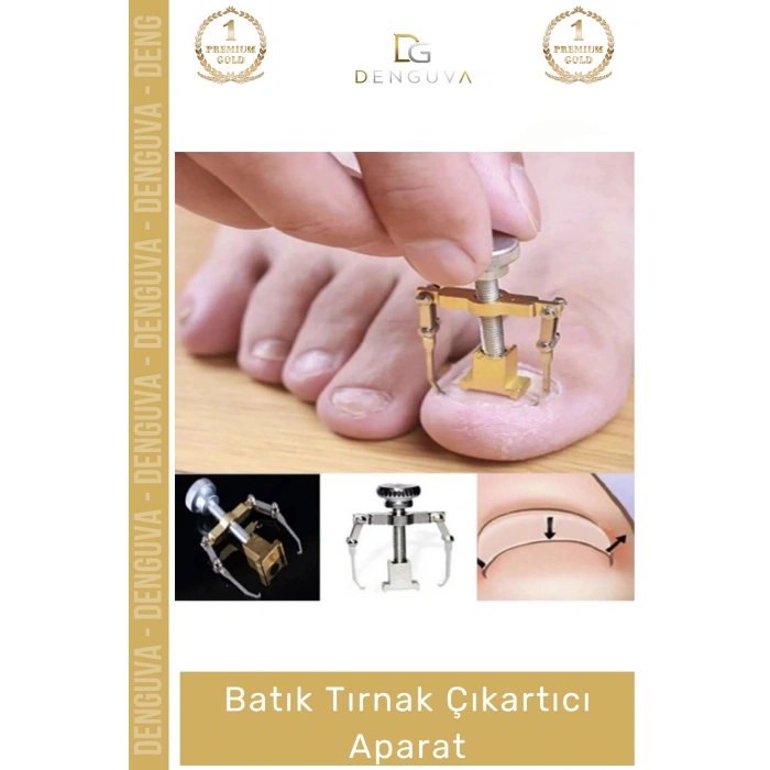#TırnakBakım Batık Tırnak Düzeltici Profesyonel Ayak Sağlığı Bakım Düzeltme Çıkartıcı Pens Aparat