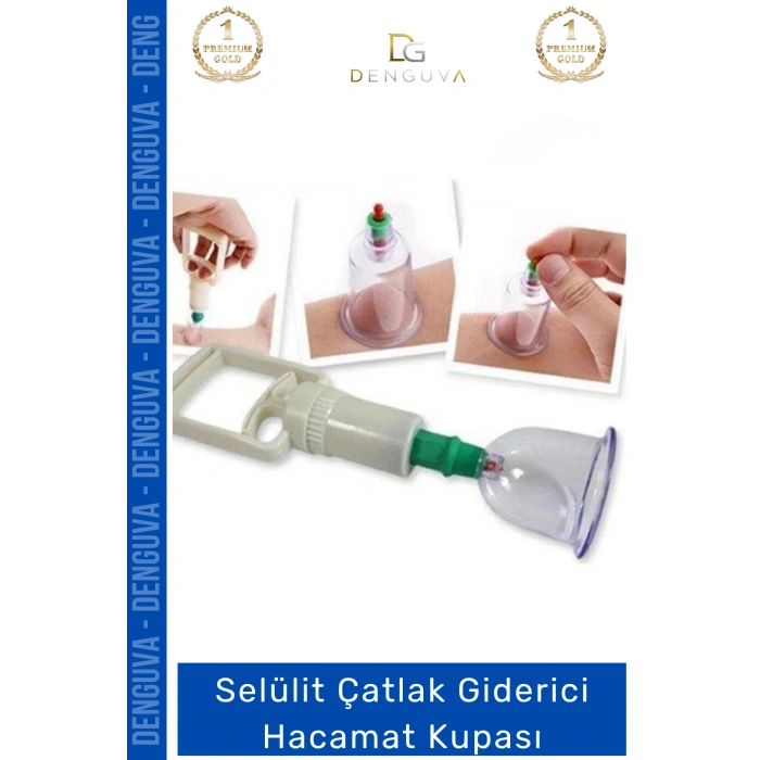 #HacamatKupası Kaliteli Vakumlu Dayanıklı Tıbbi Steril Büyük Boy Sırt 7 Numara Hacamat Kupası 10 Adet