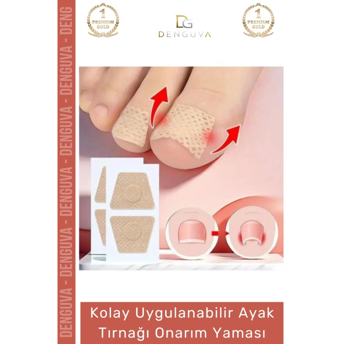 #YaraBandı Kolay Uygulanabilir Mantar Karşıtı Sararma Giderici Bakım Ayak Tırnağı Onarım Yaması
