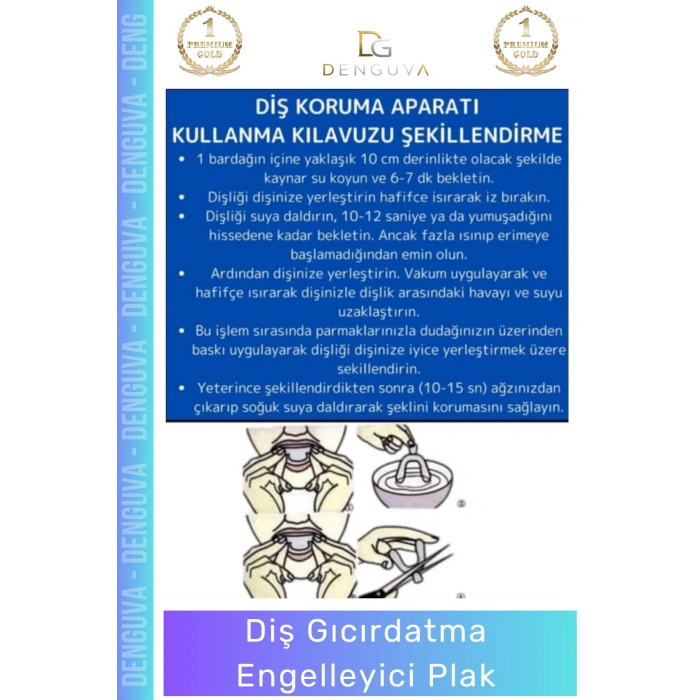 #DişAparatı Bruksizm Diş Sıkma Aparatı Gece Plağı Koruyucu Termoplastik Gıcırdatma Engelleyici Plak