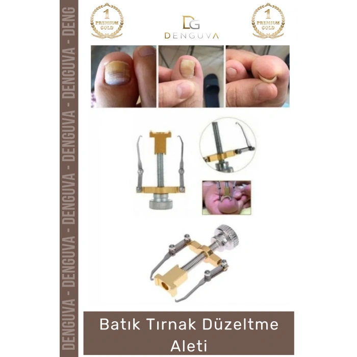 #TırnakDüzeltme Profesyonel Pedikür Ayak Sağlığı Bakım Seti Aparatı Ağrısız Batık Tırnak Düzeltme Aleti