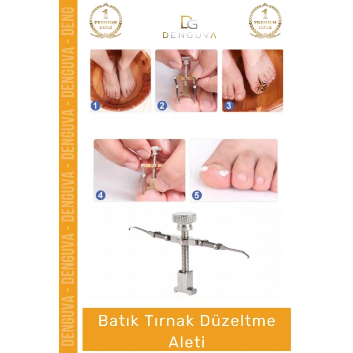 #TırnakDüzeltici Profesyonel Ayak Bakım Aparatı Ev Tipi Etkili Tırnak Çıkartıcı Batık Tırnak Düzeltici