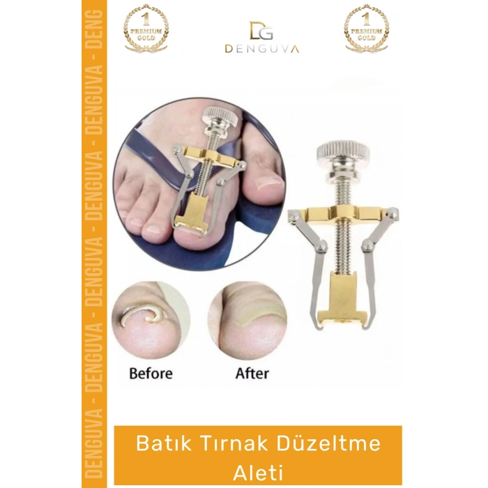 #TırnakDüzeltici Profesyonel Ayak Bakım Aparatı Ev Tipi Etkili Tırnak Çıkartıcı Batık Tırnak Düzeltici