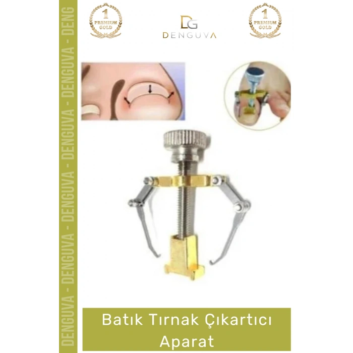 #TırnakAparatı Nordmende Paslanmaz Çelik Profesyonel Ayak Bakım Pedikür Batık Tırnak Çıkarma Aparatı