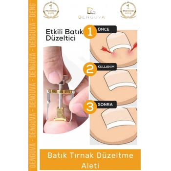 #TırnakDüzeltici Profesyonel Ayak Bakım Aparatı Ev Tipi Etkili Tırnak Çıkartıcı Batık Tırnak Düzeltici