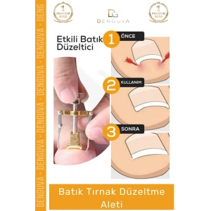 #TırnakDüzeltici Profesyonel Ayak Bakım Aparatı Ev Tipi Etkili Tırnak Çıkartıcı Batık Tırnak Düzeltici