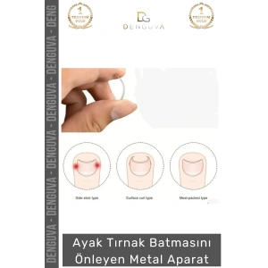 #TırnakAparatı Profesyonel Paslanmaz Çelik Ayarlanabilir Hijyenik Tırnak Batmasını Önleyen Metal Aparat