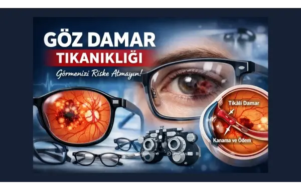 Göz Damar Tıkanıklığı