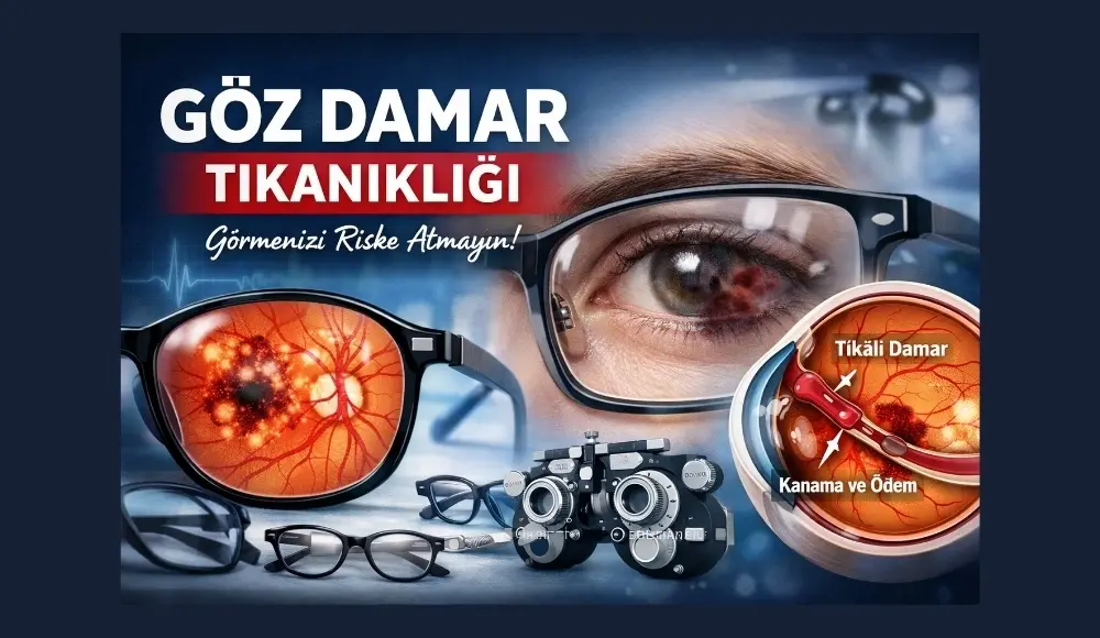 Göz Damar Tıkanıklığı