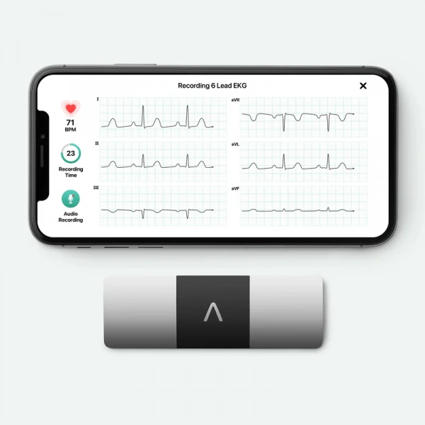AliveCor KardiaMobile 6L Akıllı Mini EKG Kardiyo Cihazı