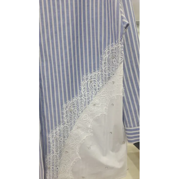 Nuss 3007 Dantel Detay Düğmeil Tunik - mavi