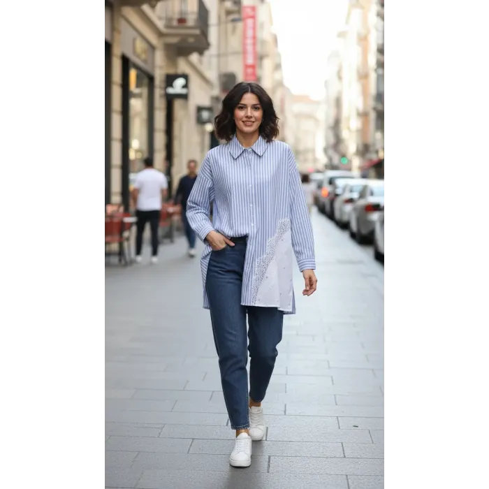 Nuss 3007 Dantel Detay Düğmeil Tunik - mavi