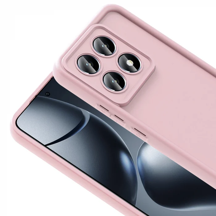 Xiaomi 14T Kılıf Kamera Korumalı Ananas Kapak