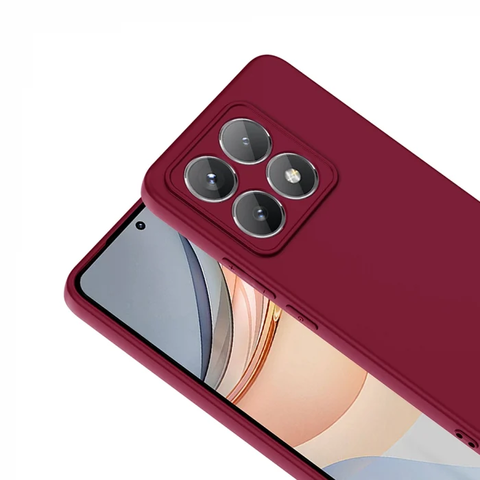 Xiaomi 14T Kılıf Mara Lansman Kapak