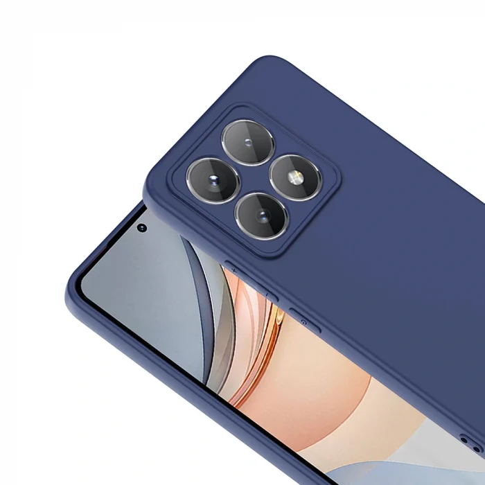 Xiaomi 14T Kılıf Mara Lansman Kapak