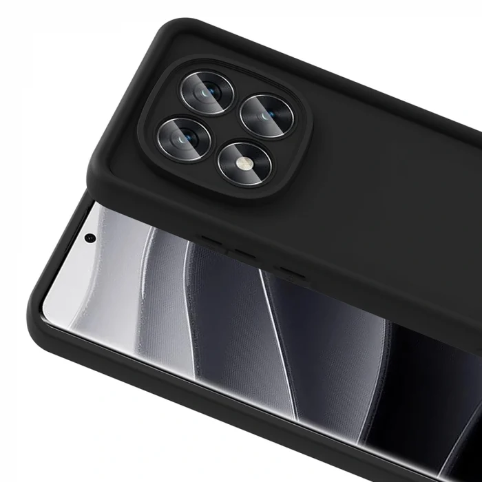 Xiaomi Redmi Note 14 Pro 5G Kılıf Kamera Korumalı Ananas Kapak