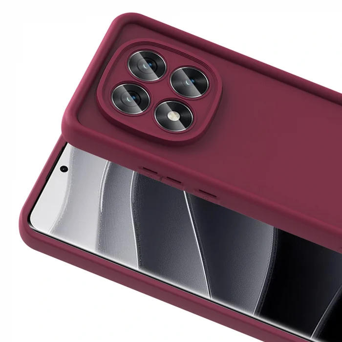 Xiaomi Redmi Note 14 Pro 5G Kılıf Kamera Korumalı Ananas Kapak