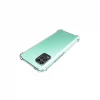 Xiaomi Mi 10 Lite Kılıf Nitro Anti Shock Silikon